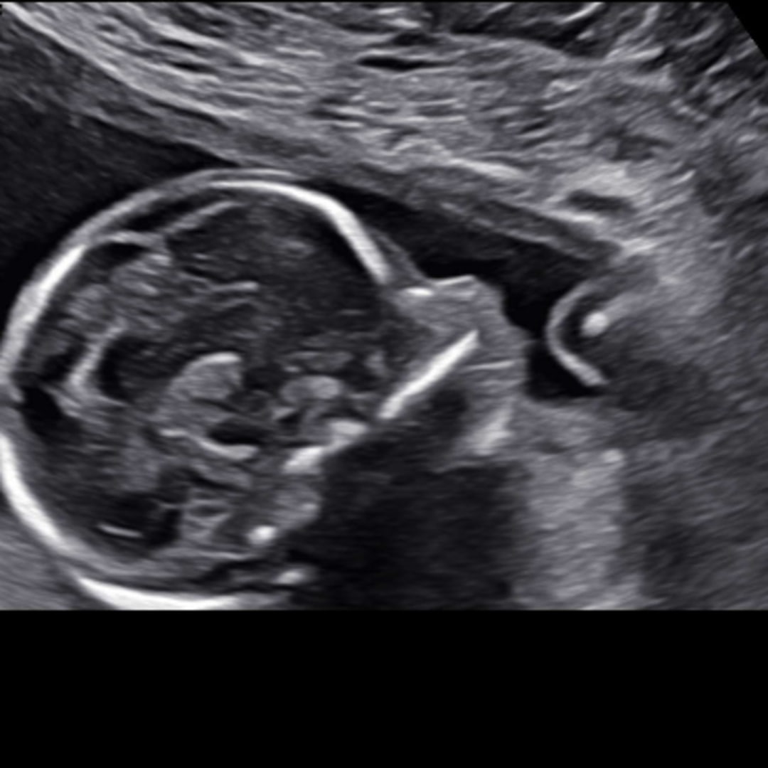 Photo shared by Crystal for their Babylist baby registry.