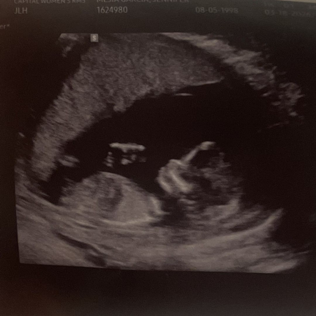 Photo shared by Jennifer for their Babylist baby registry.