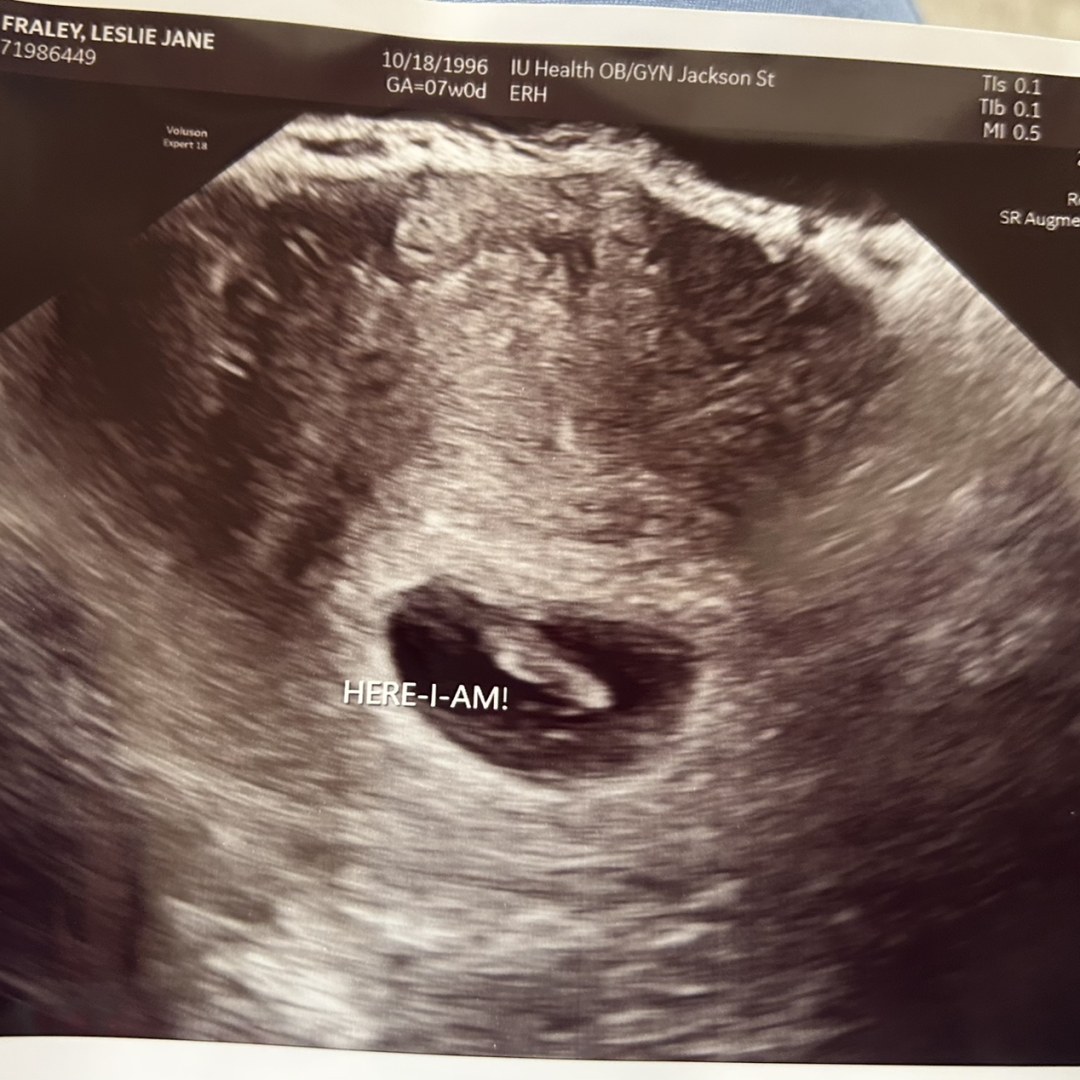 Photo shared by Leslie for their Babylist baby registry.