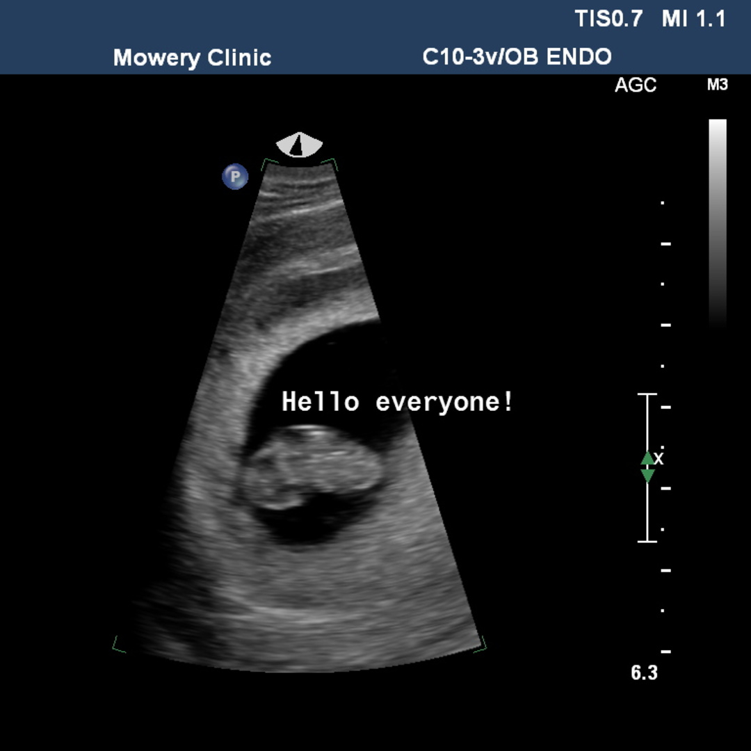 Photo shared by Allyson for their Babylist baby registry.