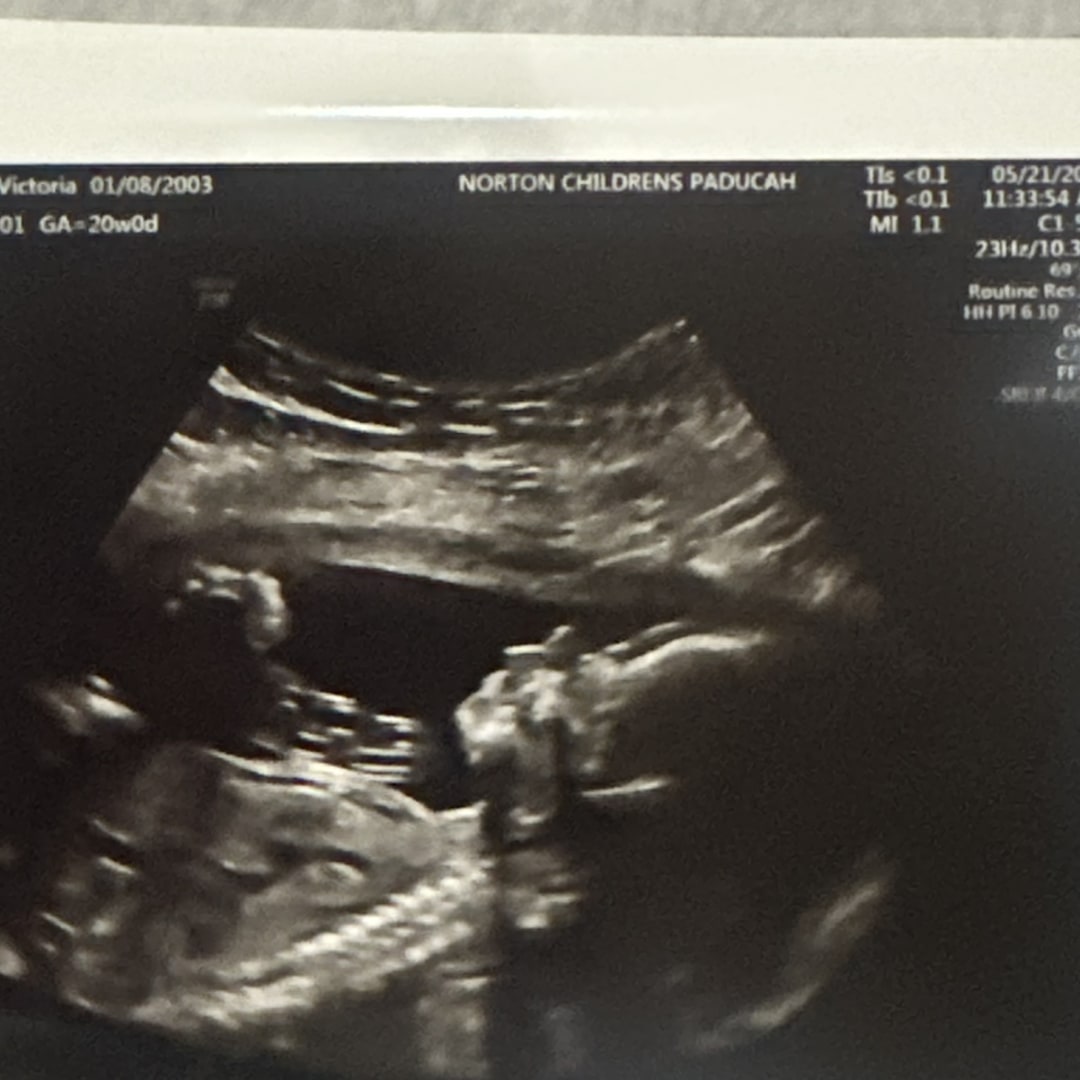 Photo shared by Victoria for their Babylist baby registry.