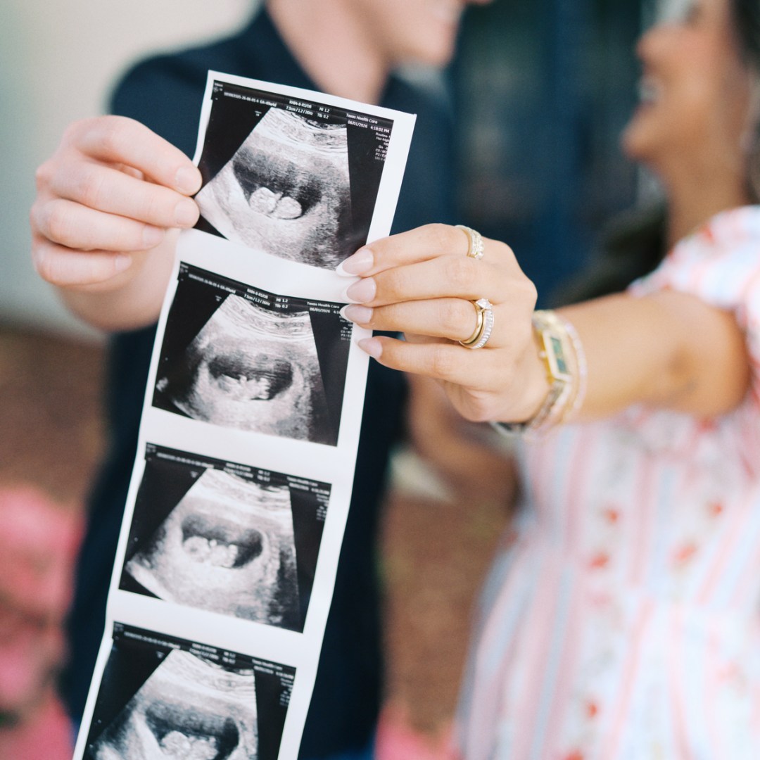 Photo shared by Yetzy for their Babylist baby registry.