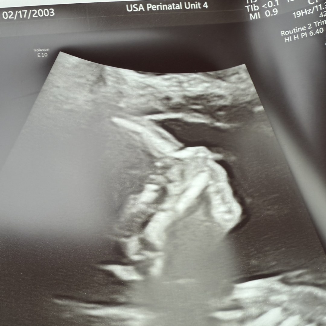 Photo shared by Breanna for their Babylist baby registry.