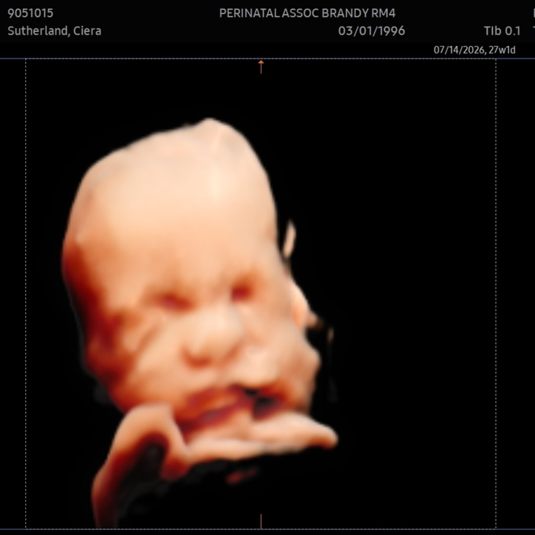 Photo shared by Ciera for their Babylist baby registry.