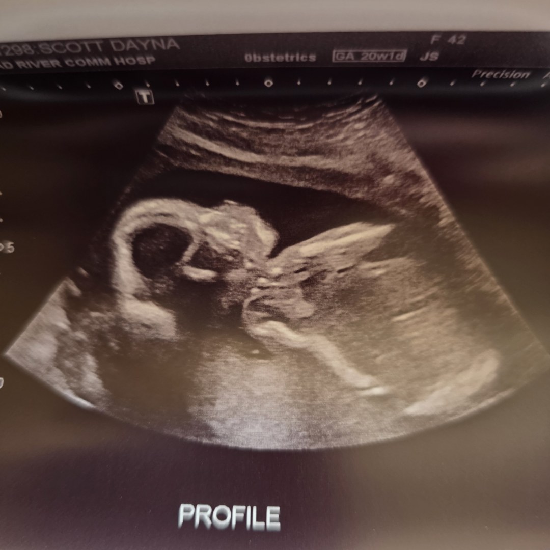 Photo shared by Dayna for their Babylist baby registry.