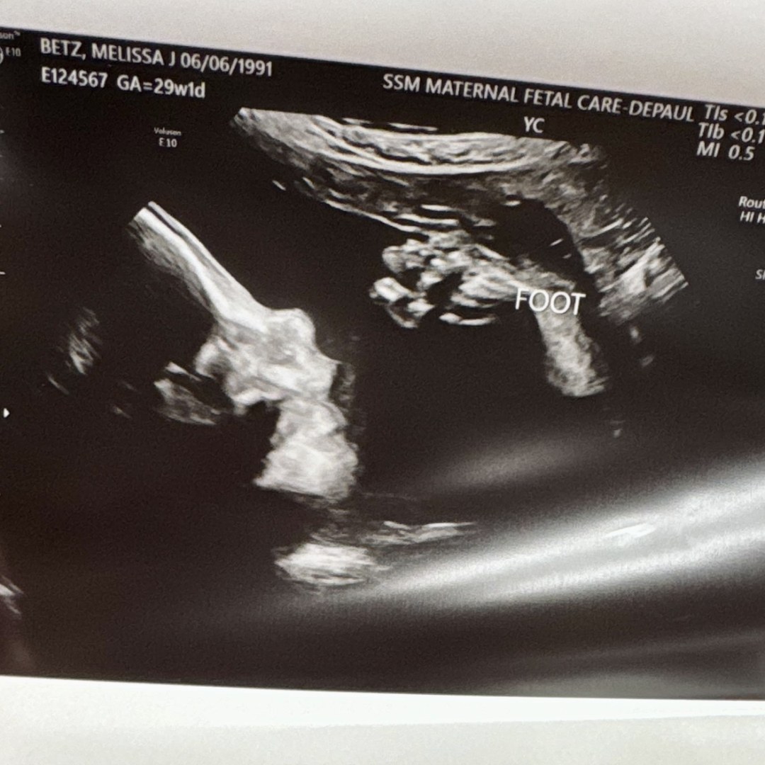 Photo shared by Melissa for their Babylist baby registry.
