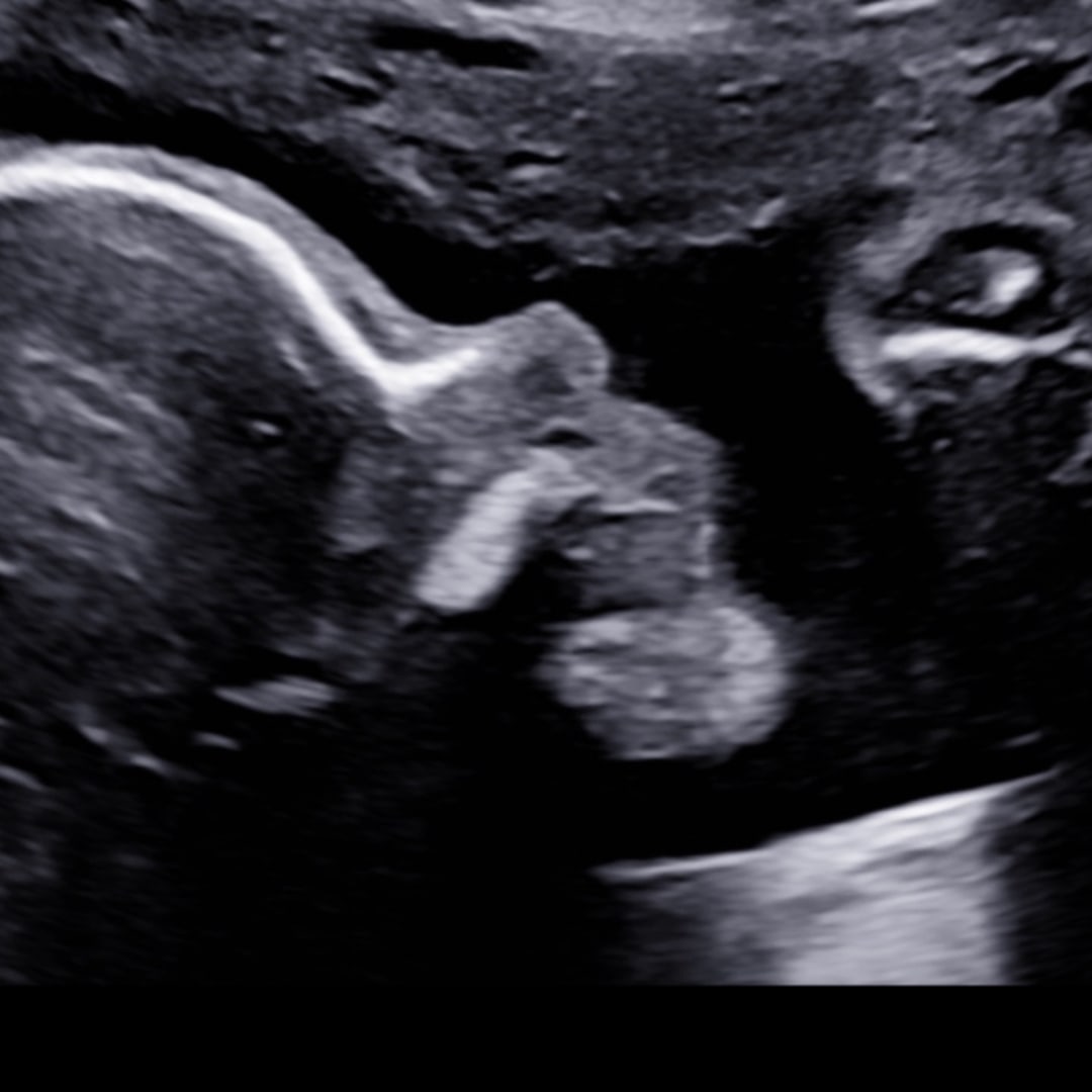 Photo shared by Hannah for their Babylist baby registry.