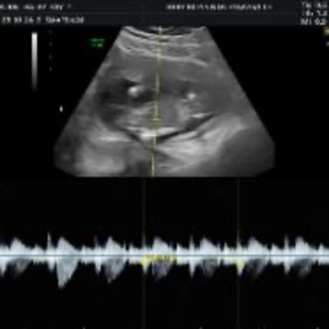 Photo shared by Haley-Kay for their Babylist baby registry.