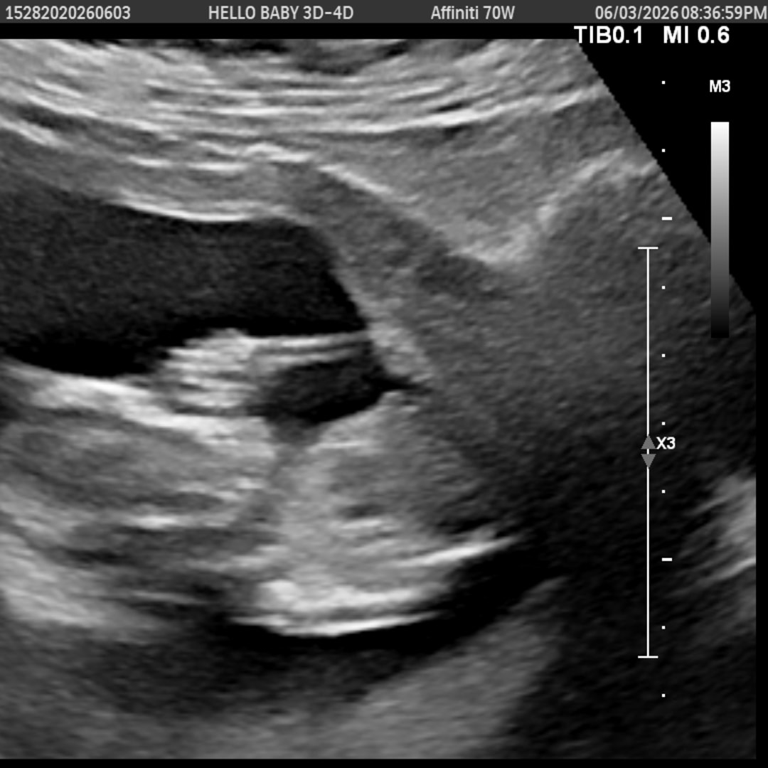 Photo shared by Jalyn for their Babylist baby registry.