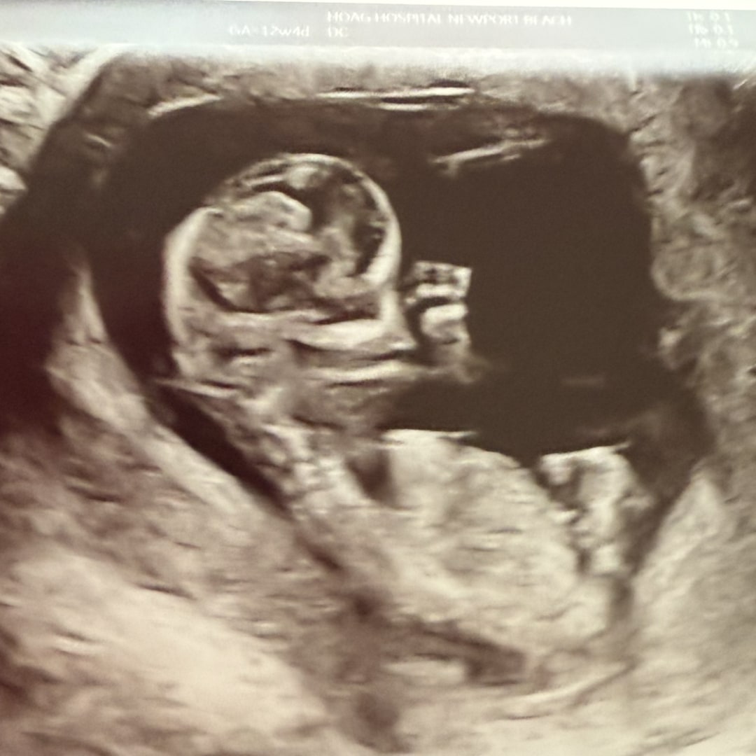 Photo shared by Ally for their Babylist baby registry.