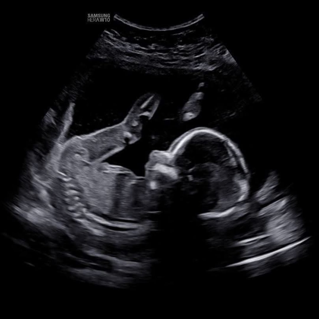 Photo shared by Addison for their Babylist baby registry.