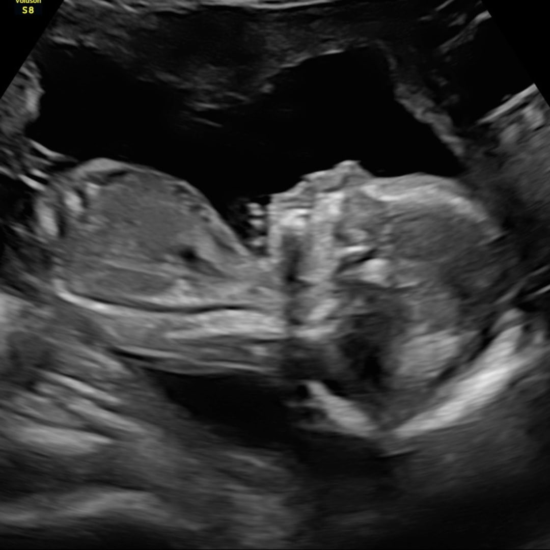 Photo shared by Whitney for their Babylist baby registry.