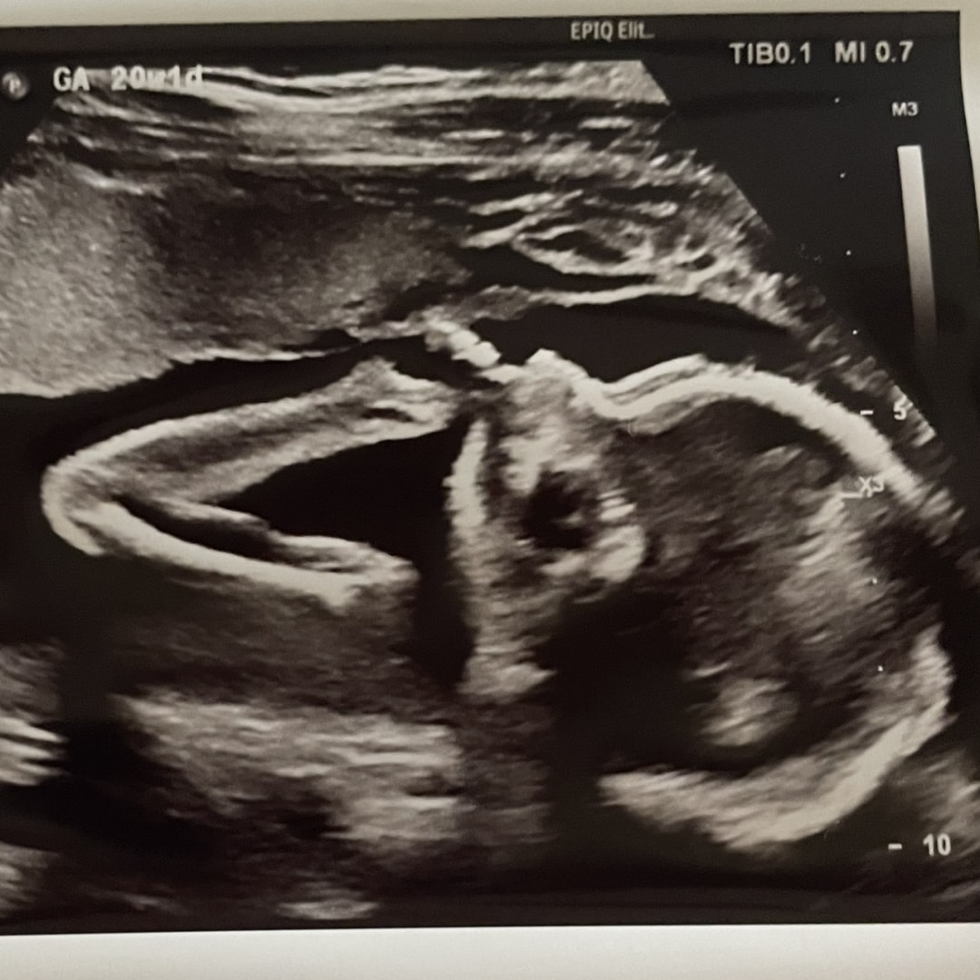 Photo shared by Sienna for their Babylist baby registry.