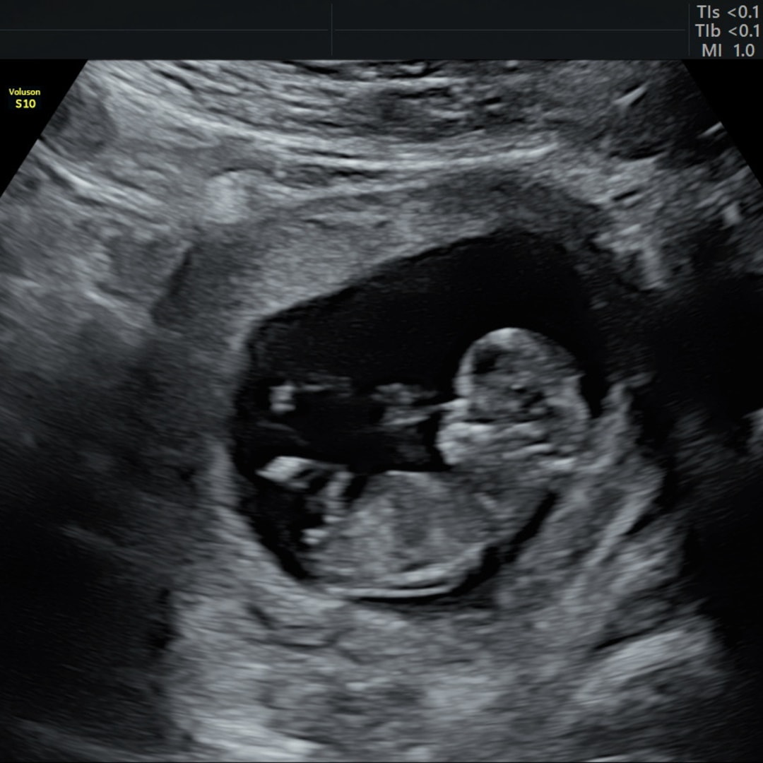 Photo shared by Megan for their Babylist baby registry.