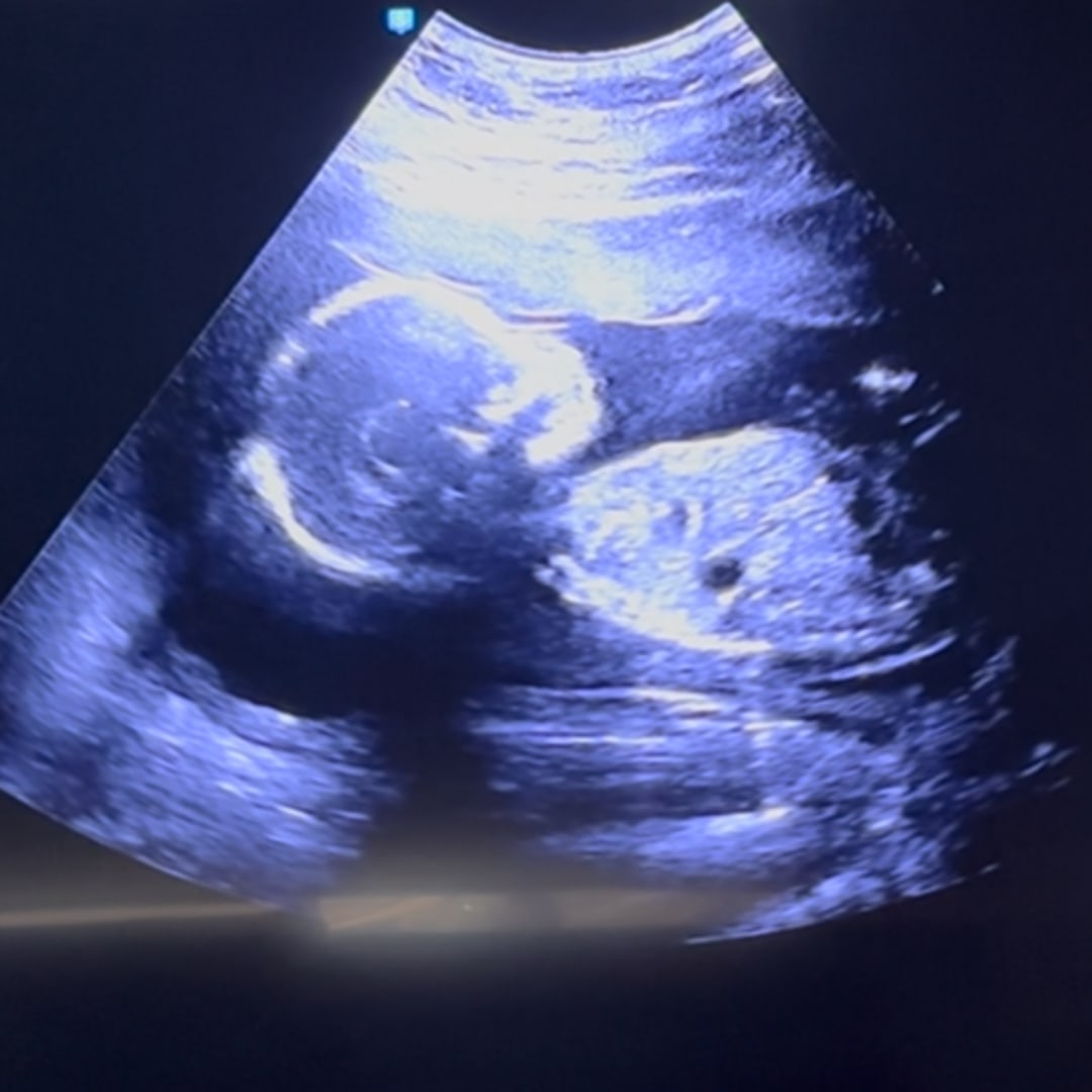 Photo shared by Amoura for their Babylist baby registry.