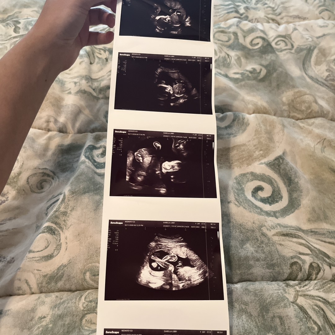 Photo shared by Isabella for their Babylist baby registry.