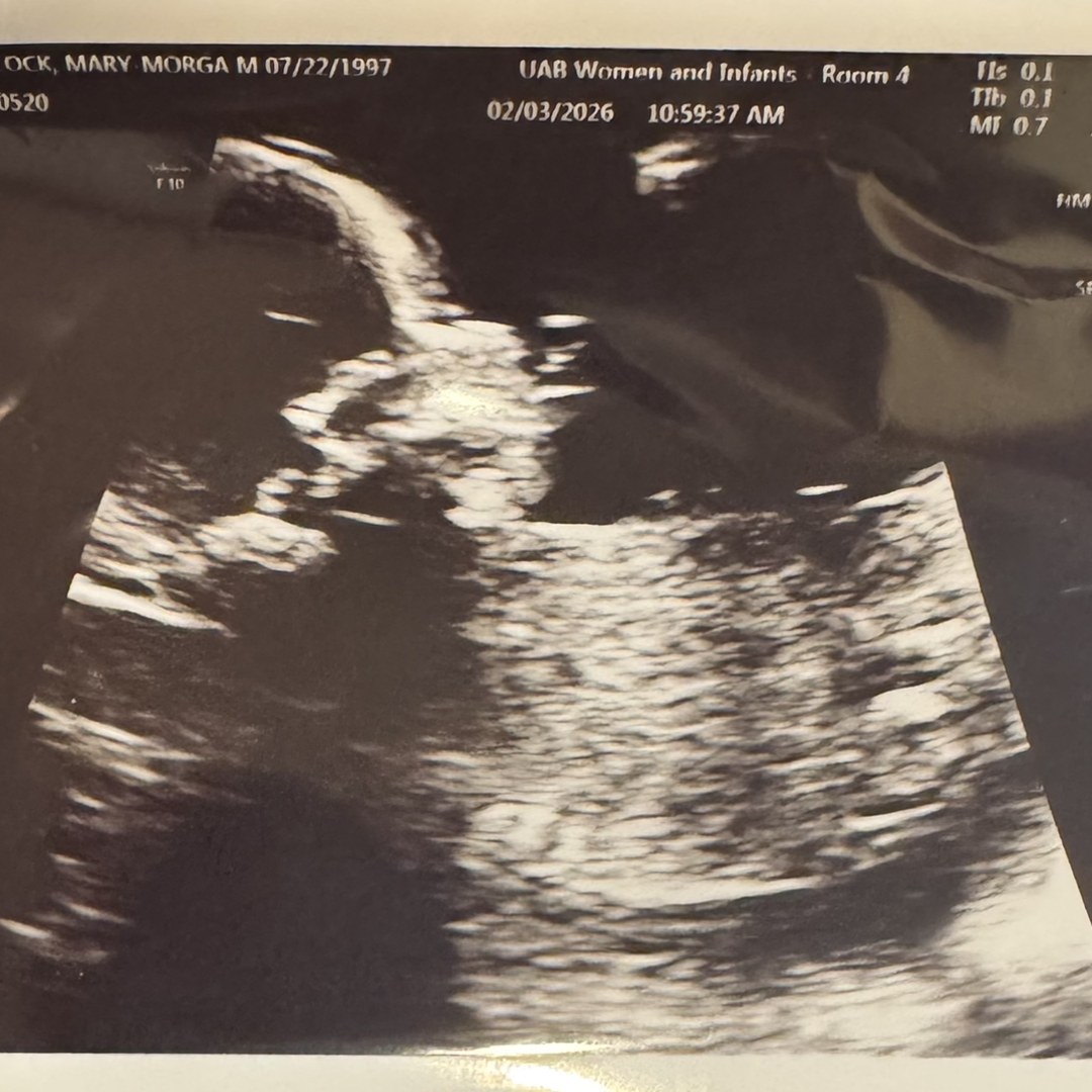 Photo shared by Mary for their Babylist baby registry.