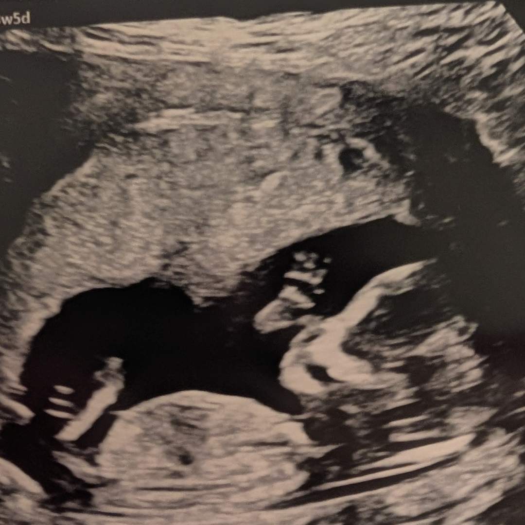 Photo shared by Dana for their Babylist baby registry.