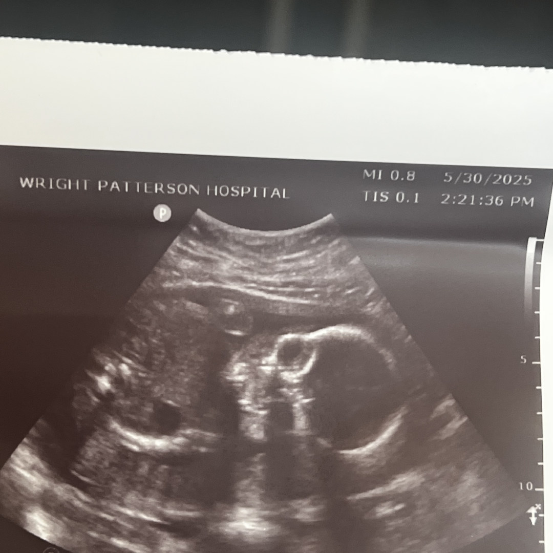 Photo shared by Richelle for their Babylist baby registry.