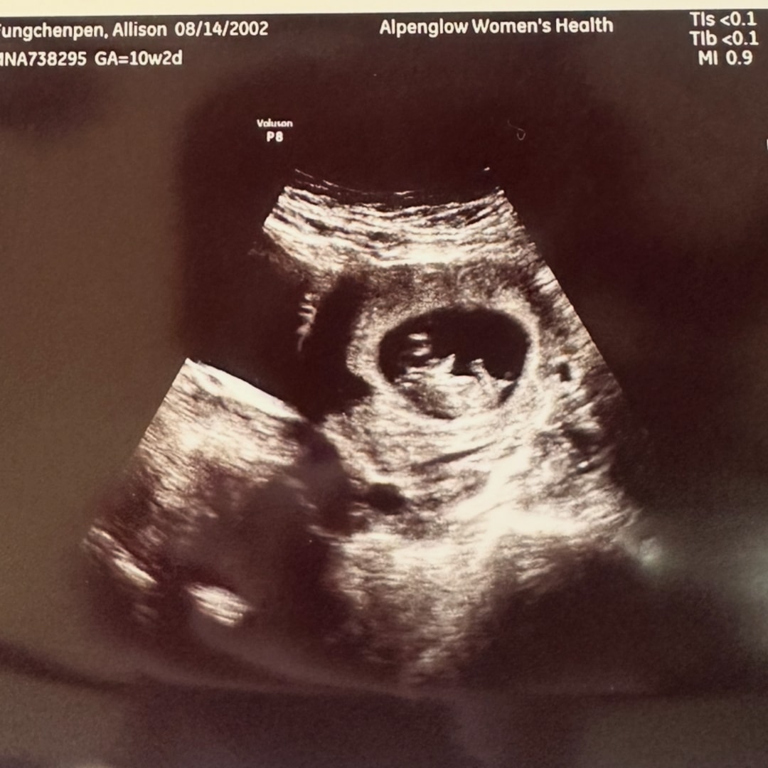 Photo shared by Alli for their Babylist baby registry.