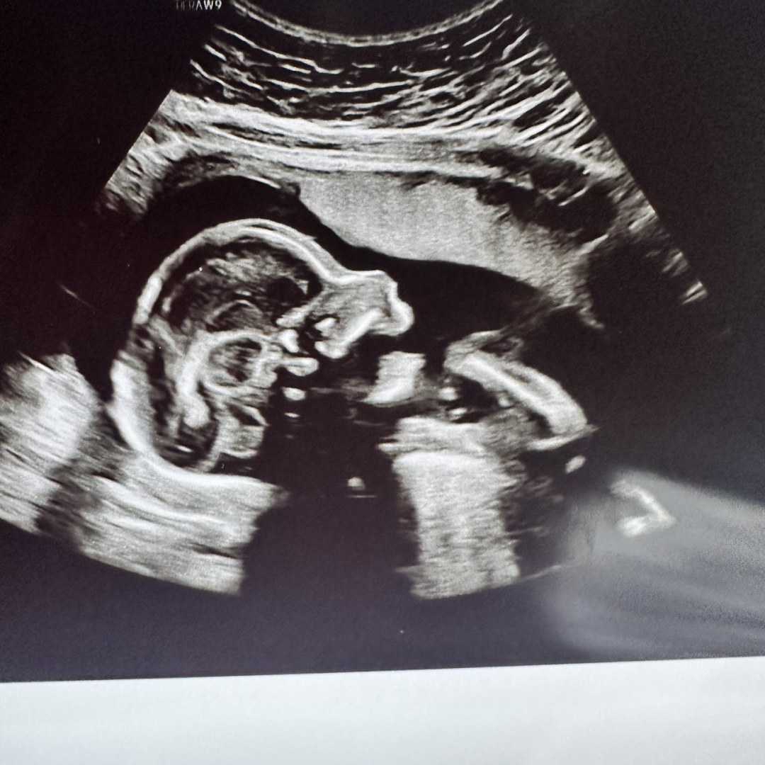 Photo shared by Paige for their Babylist baby registry.