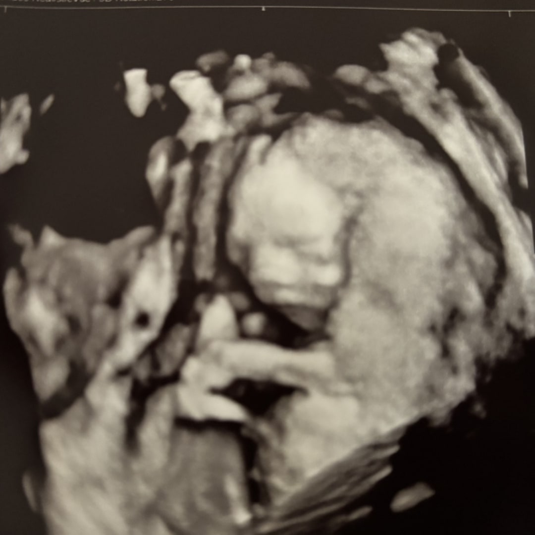Photo shared by Hailey for their Babylist baby registry.