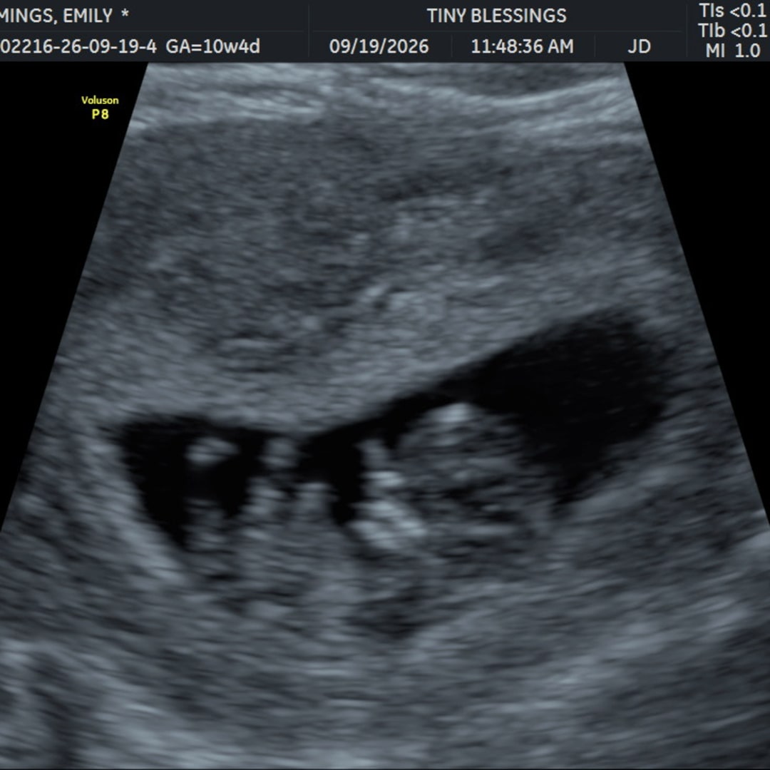 Photo shared by Emily for their Babylist baby registry.