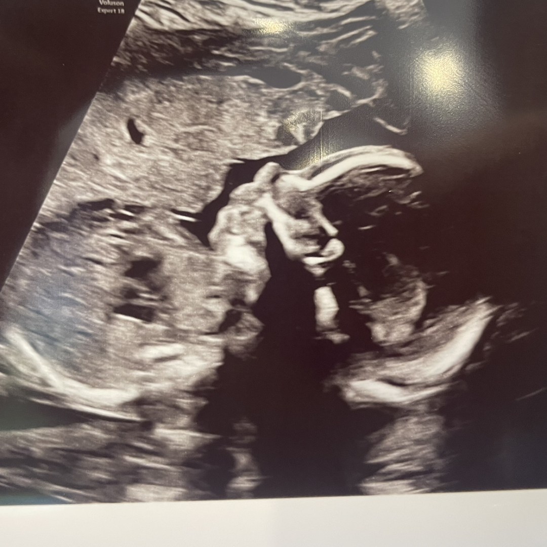 Photo shared by Molly for their Babylist baby registry.