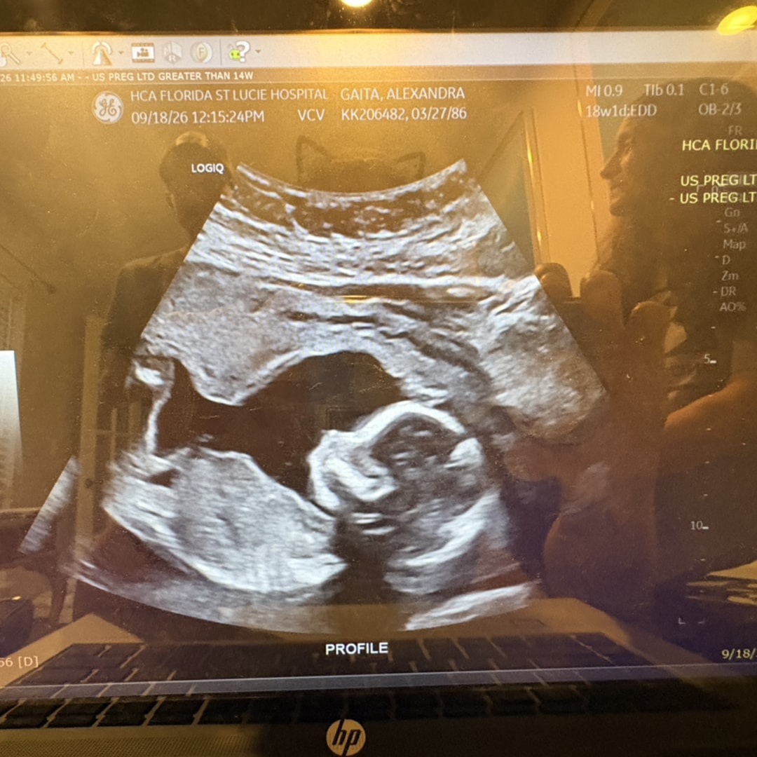 Photo shared by Alexandra for their Babylist baby registry.