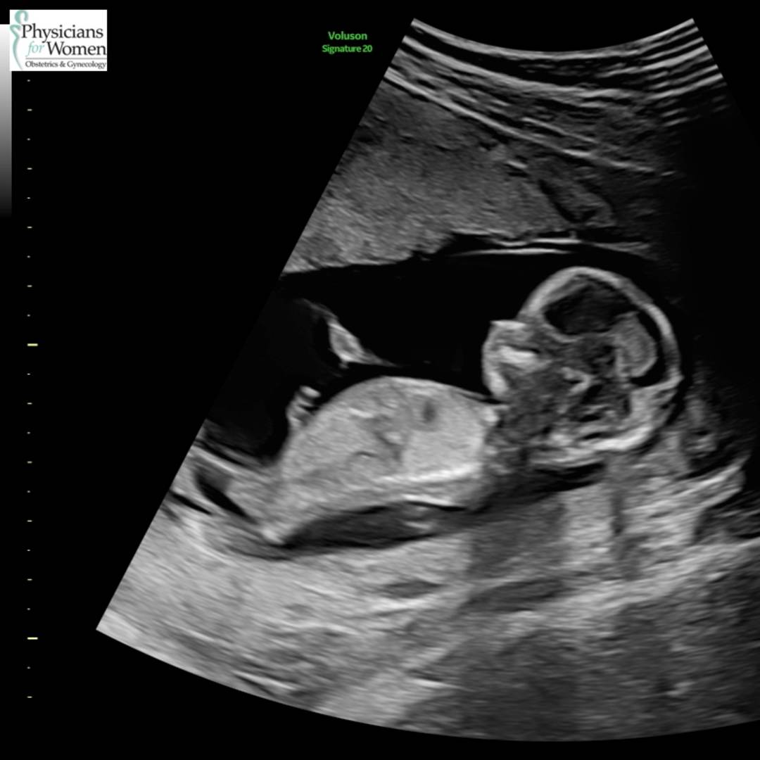 Photo shared by Christine for their Babylist baby registry.