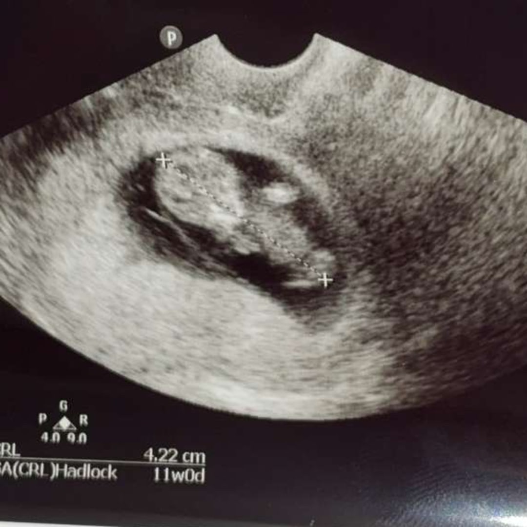 Photo shared by Madylan for their Babylist baby registry.