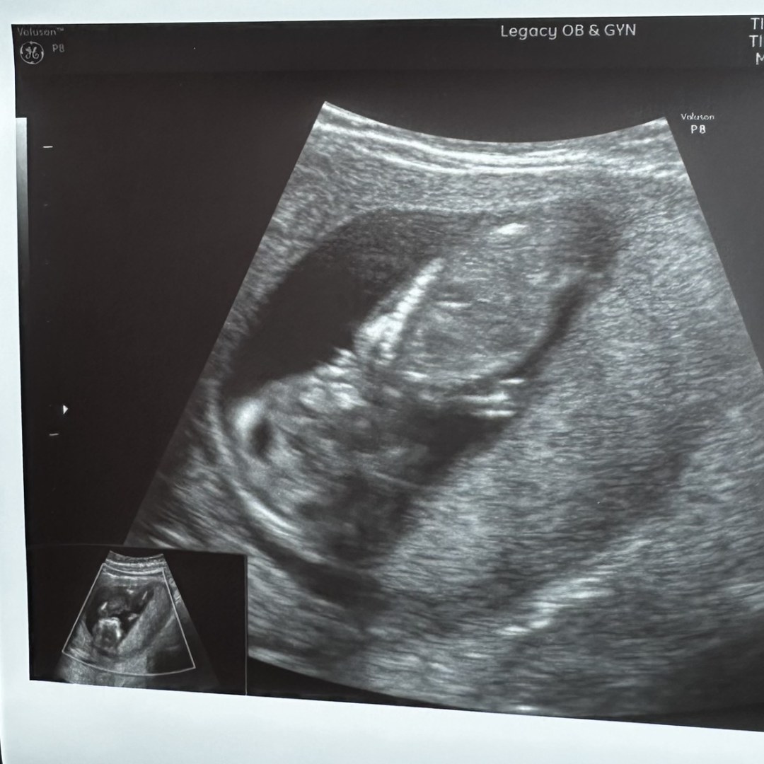 Photo shared by Madison for their Babylist baby registry.