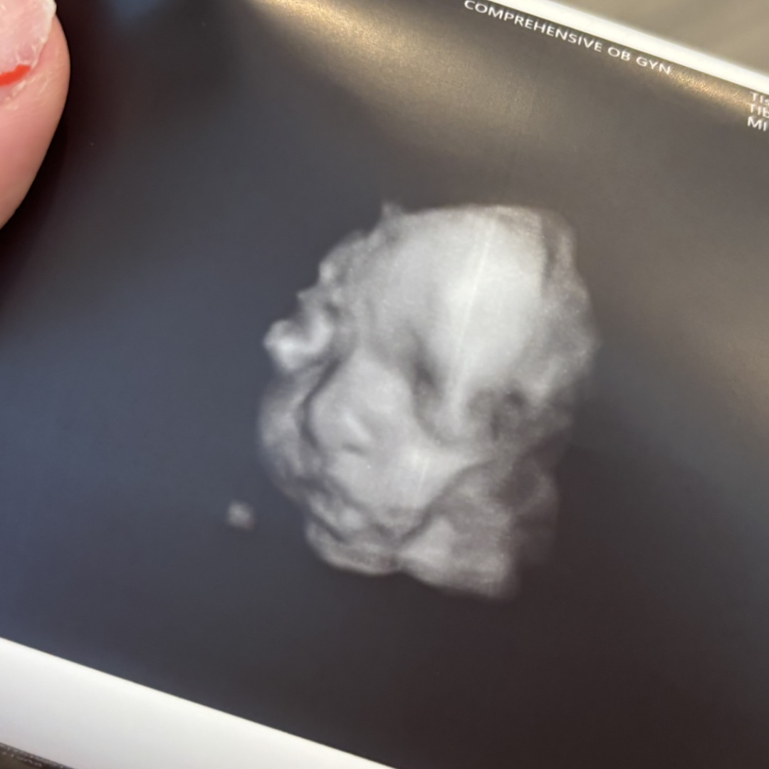 Photo shared by Abbie for their Babylist baby registry.