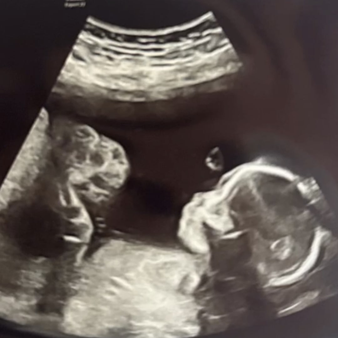 Photo shared by Maya for their Babylist baby registry.