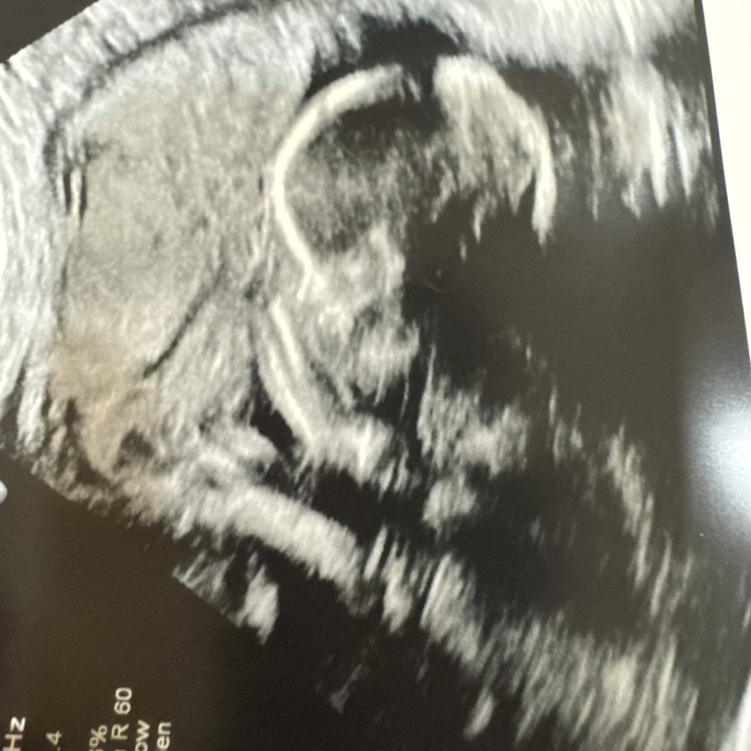 Photo shared by Meredith for their Babylist baby registry.