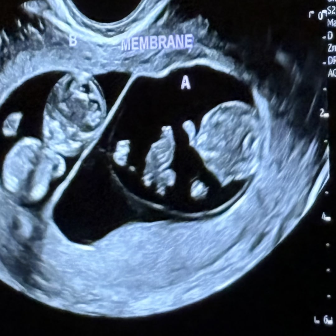 Photo shared by Christianne for their Babylist baby registry.