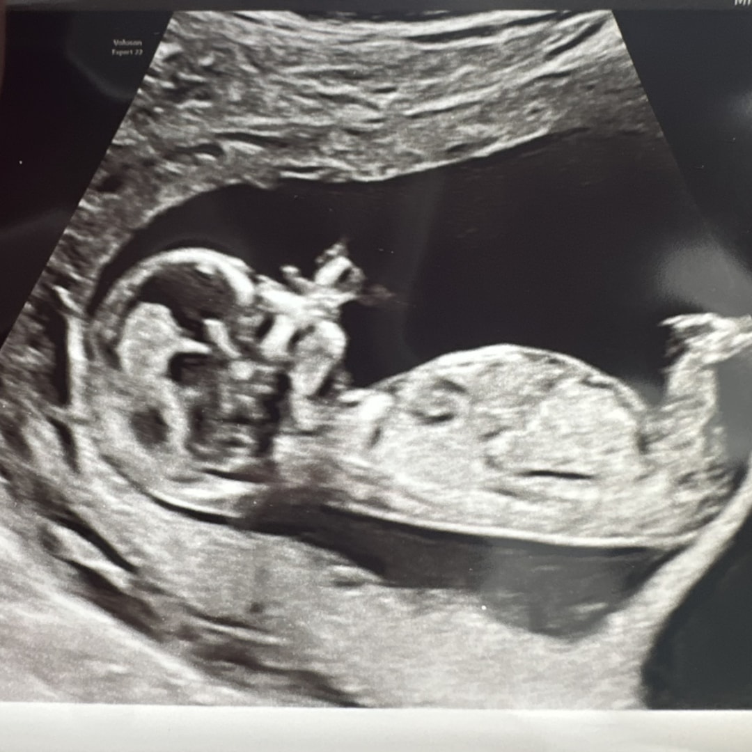 Photo shared by Allie for their Babylist baby registry.