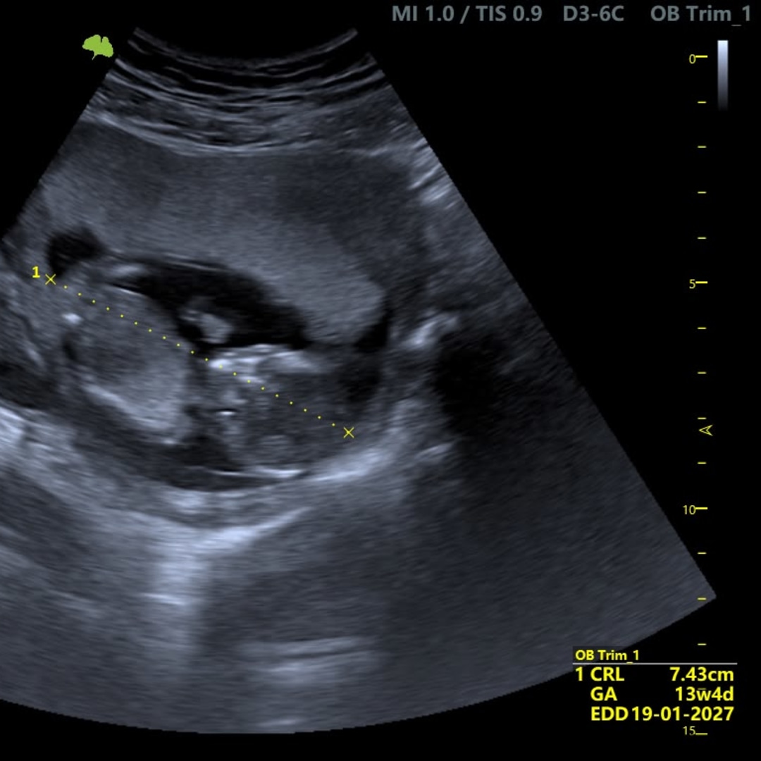 Photo shared by Danel for their Babylist baby registry.