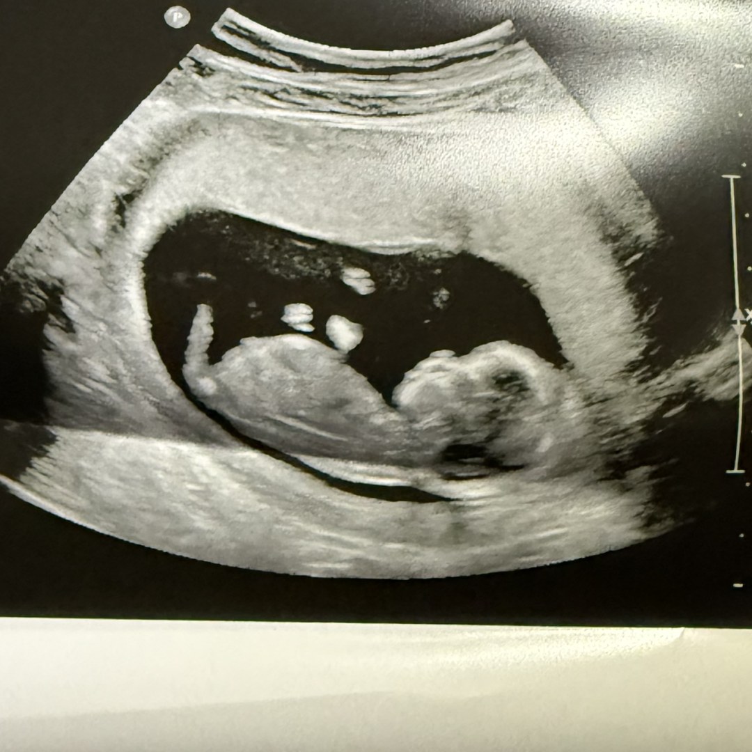 Photo shared by Bree for their Babylist baby registry.