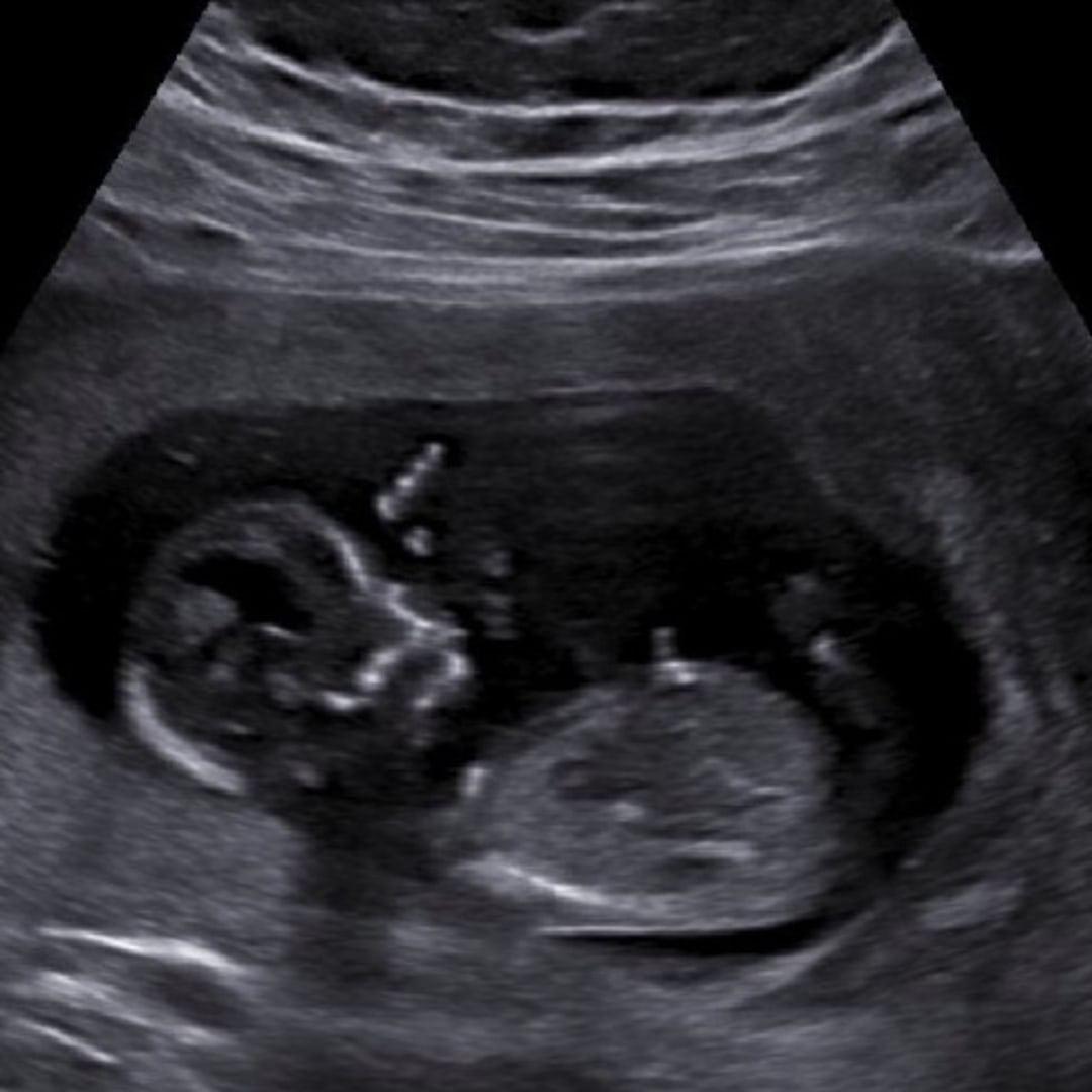 Photo shared by Fatima for their Babylist baby registry.