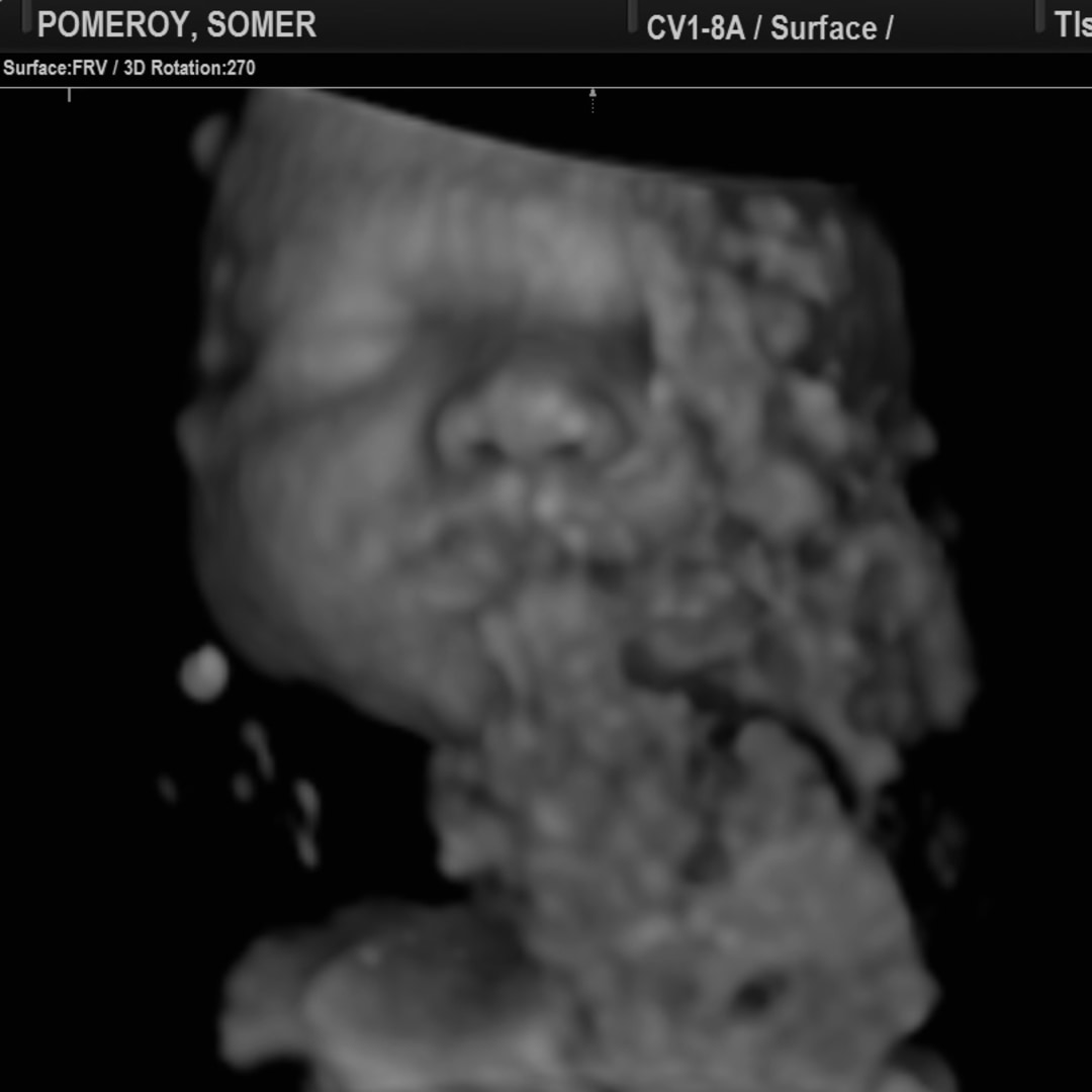 Photo shared by Somer for their Babylist baby registry.