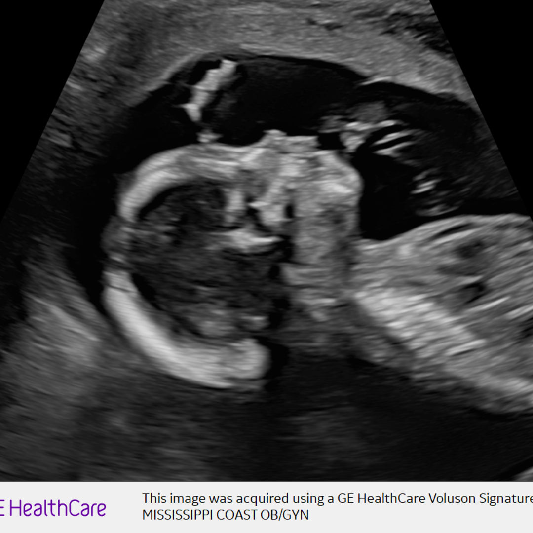 Photo shared by Kelsey for their Babylist baby registry.