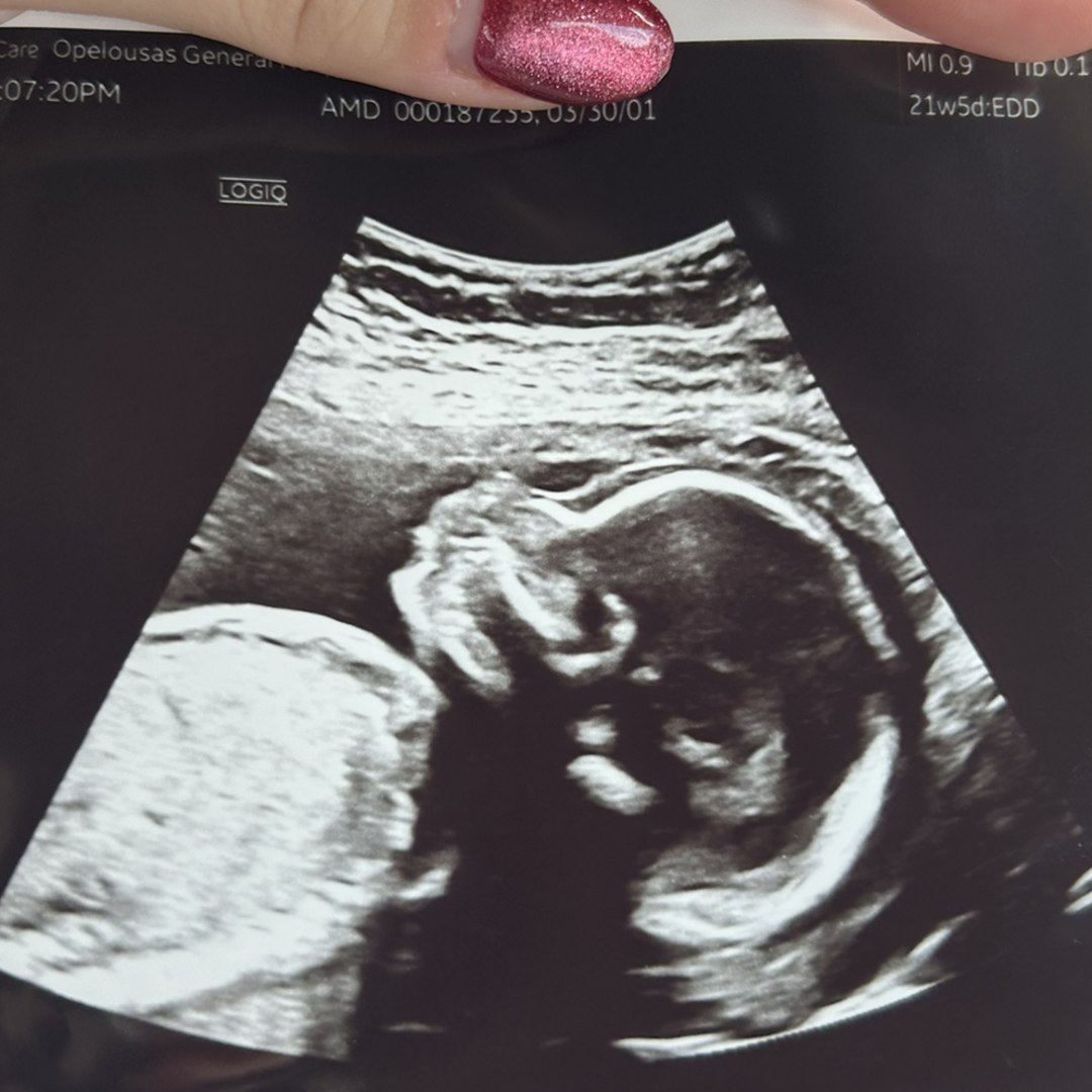 Photo shared by Destiny for their Babylist baby registry.