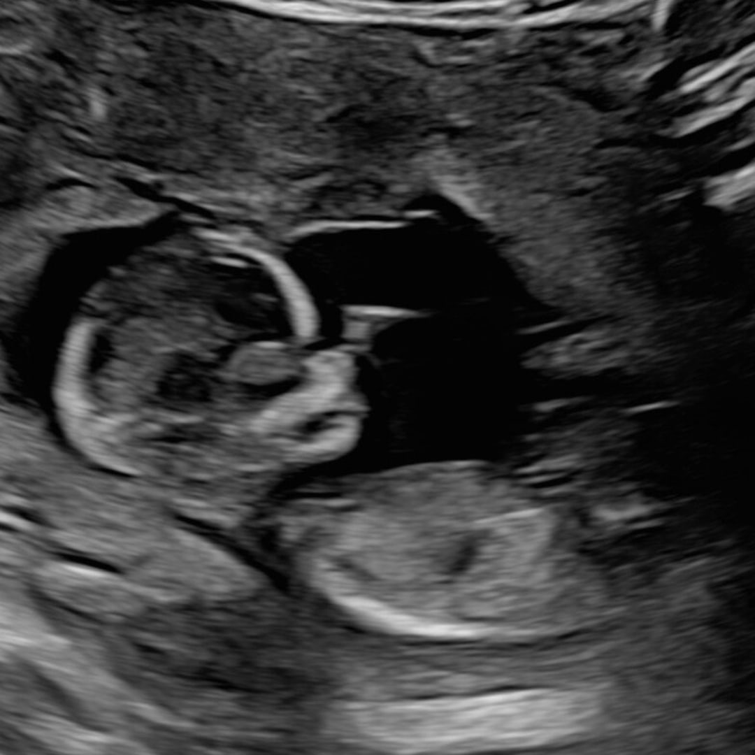 Photo shared by Beka for their Babylist baby registry.