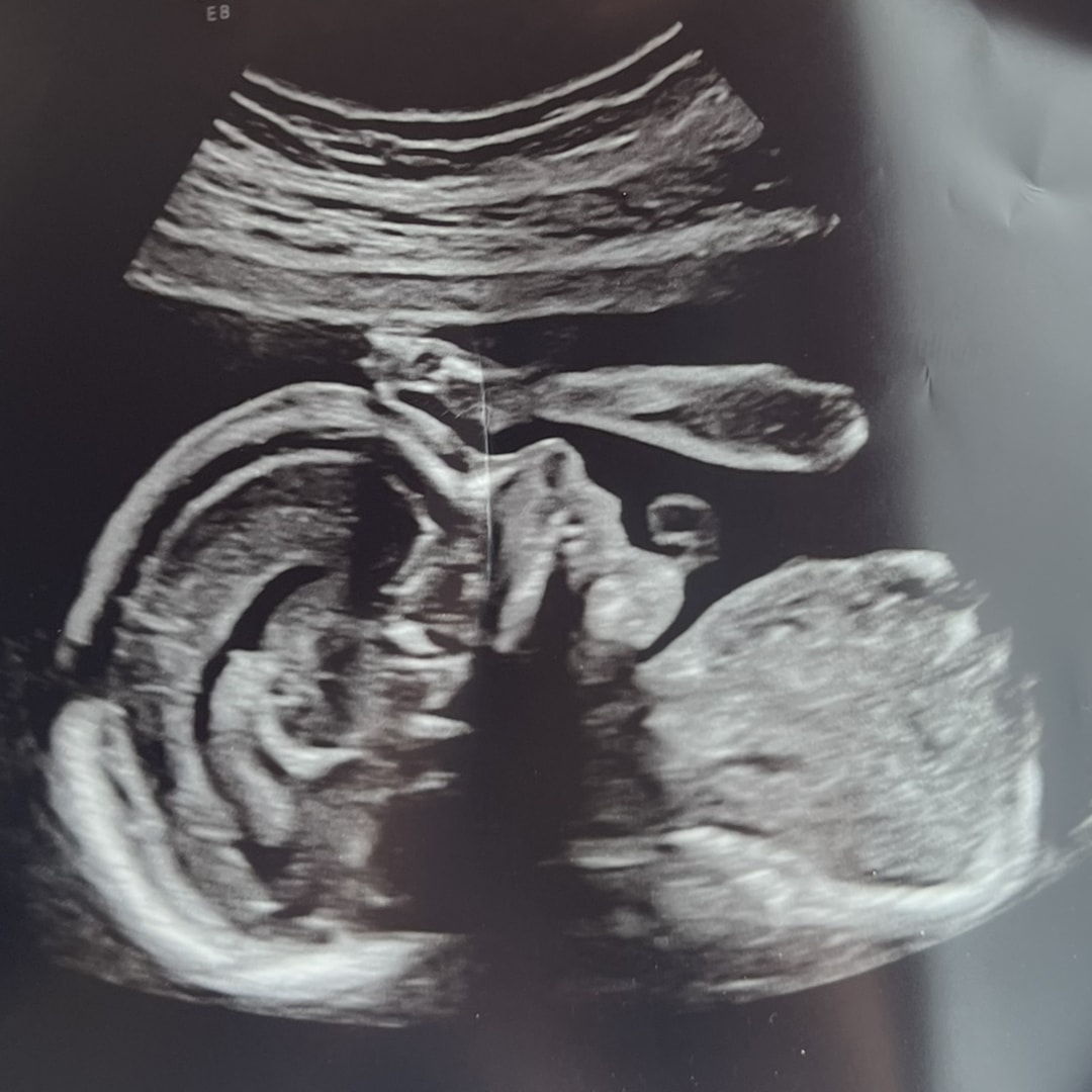 Photo shared by Makayla for their Babylist baby registry.