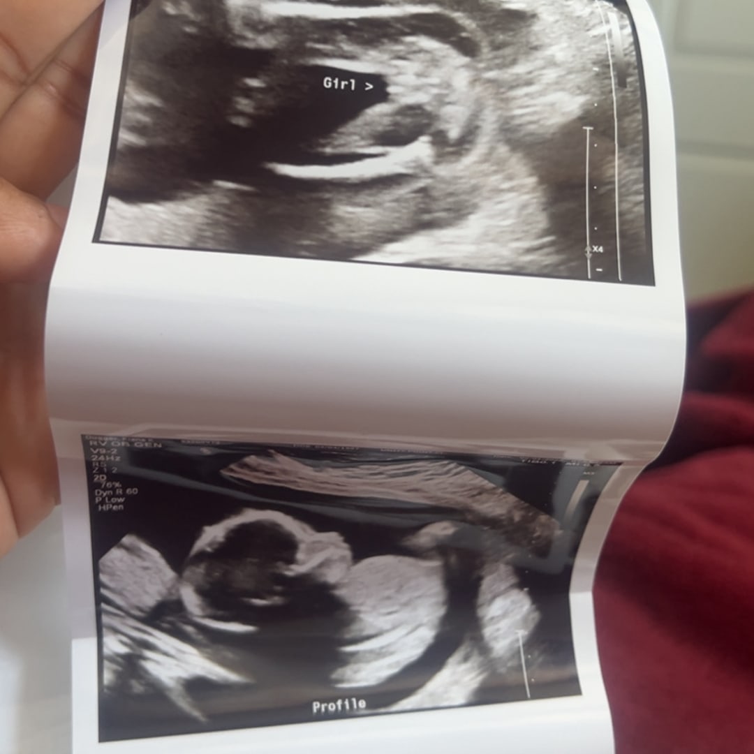 Photo shared by Kiana for their Babylist baby registry.