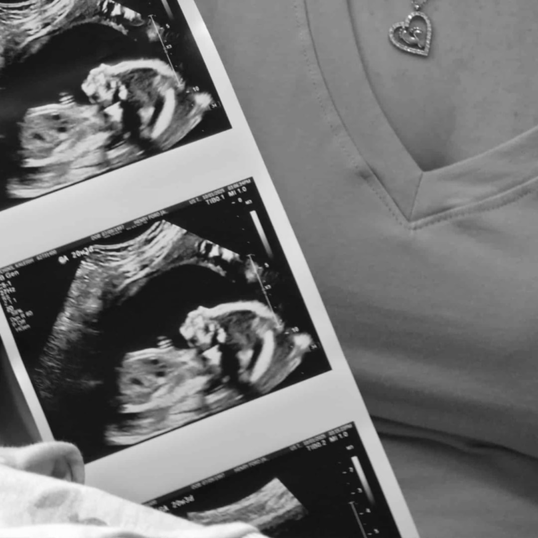 Photo shared by Austin for their Babylist baby registry.