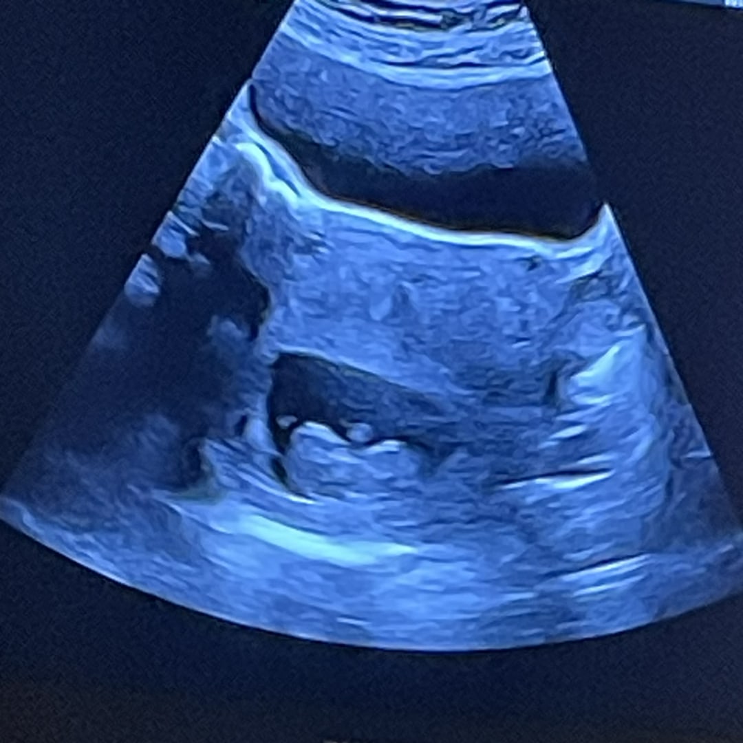 Photo shared by Allie for their Babylist baby registry.