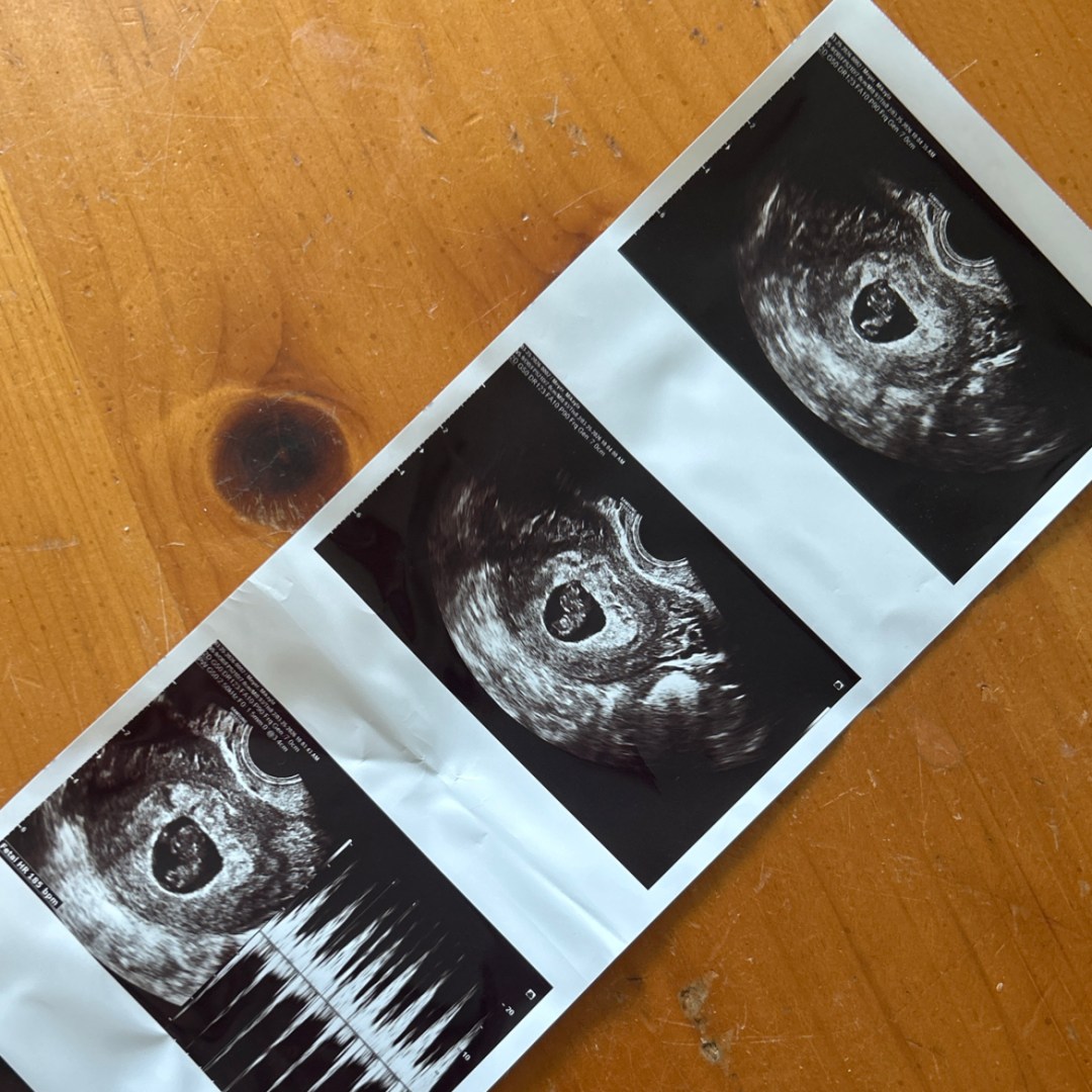 Photo shared by Mikayla for their Babylist baby registry.
