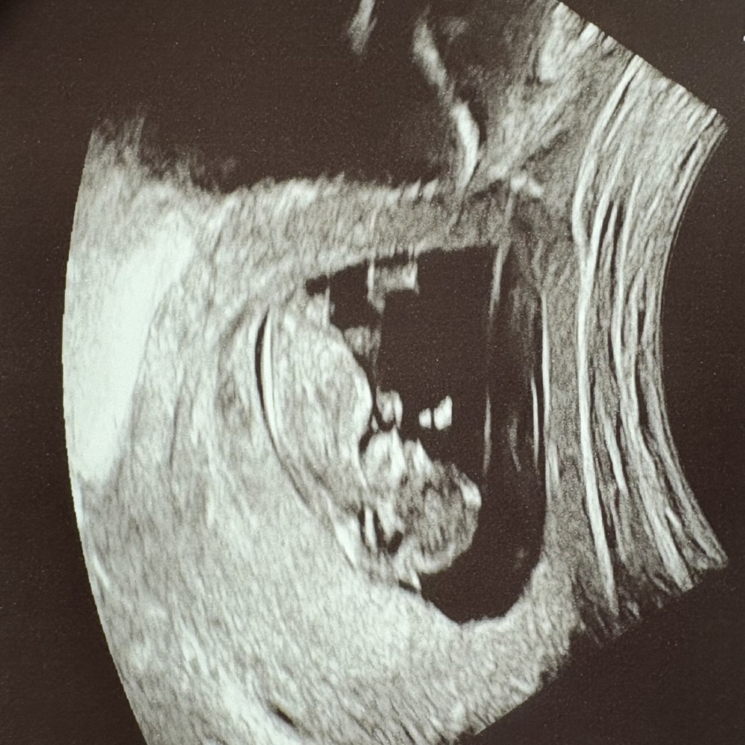 Photo shared by Trinity for their Babylist baby registry.